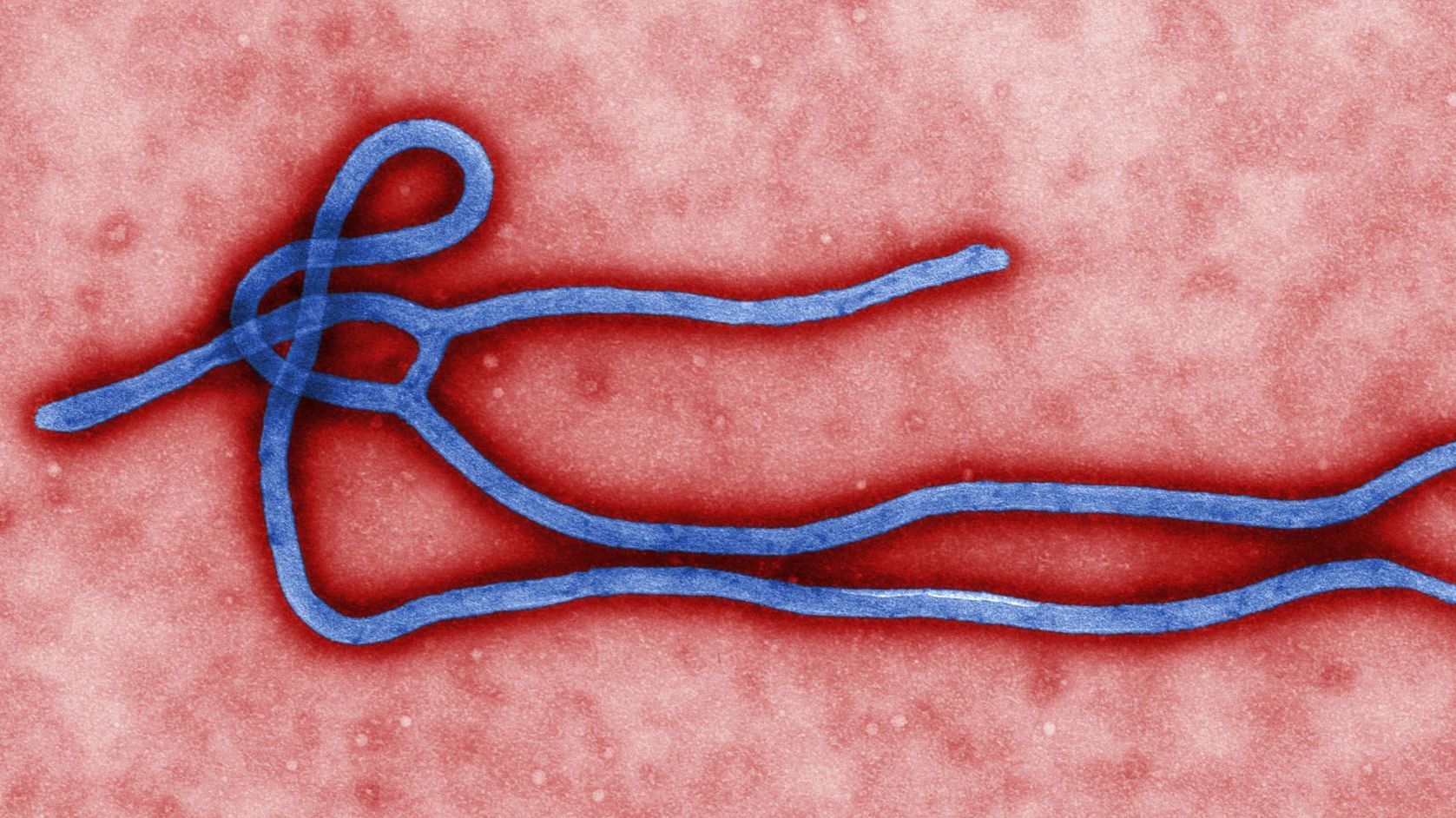 What You Need To Know About Ebola
